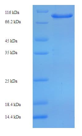 Human CCDC36 Protein (Recombinant His-SUMO)