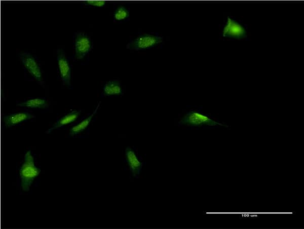 MDFI / I-MF Antibody (clone 3B4)