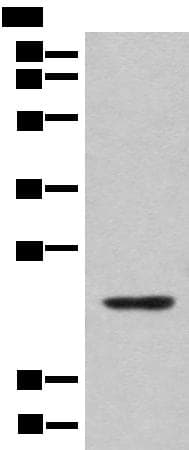 CBFB Antibody