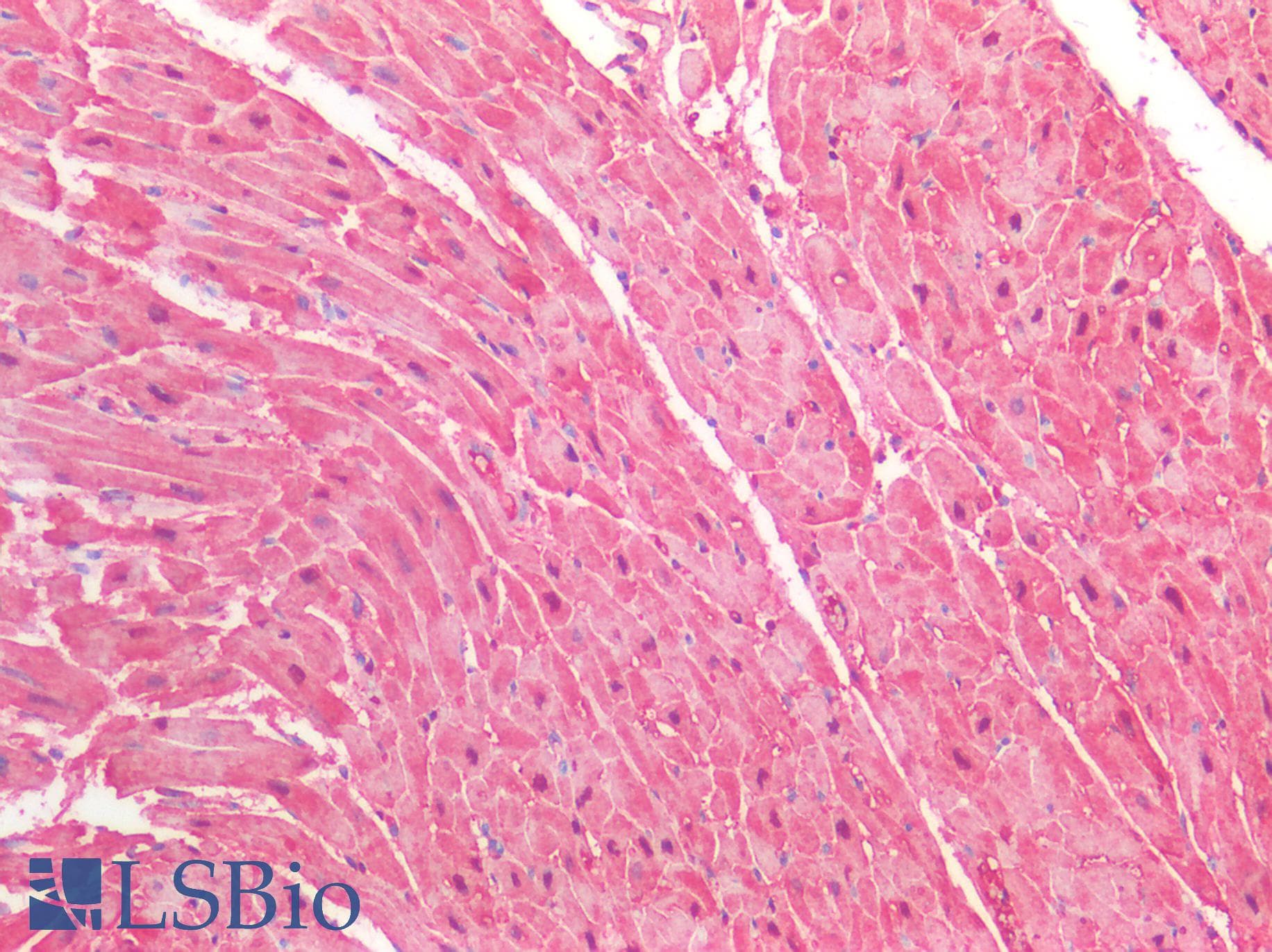 PathPlus™ MB / Myoglobin Antibody (aa1-154)