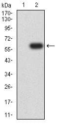 FCGRT / FCRN Antibody (clone 5F3D1)