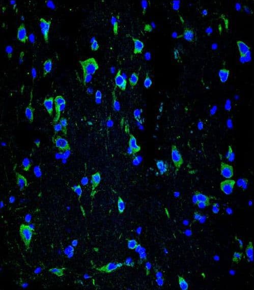 INA / Alpha Internexin Antibody (aa290-319)
