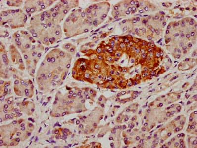 Polyclonal Rabbit anti-Human SDHAF2 Antibody (IHC, IF)
