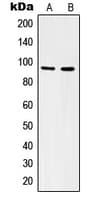 ITGAV/Integrin Alpha V/CD51 Antibody (C-Terminus)