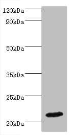Polyclonal Rabbit anti-Human IFNA4 / Interferon Alpha 4 Antibody (aa24-189, IHC, WB)