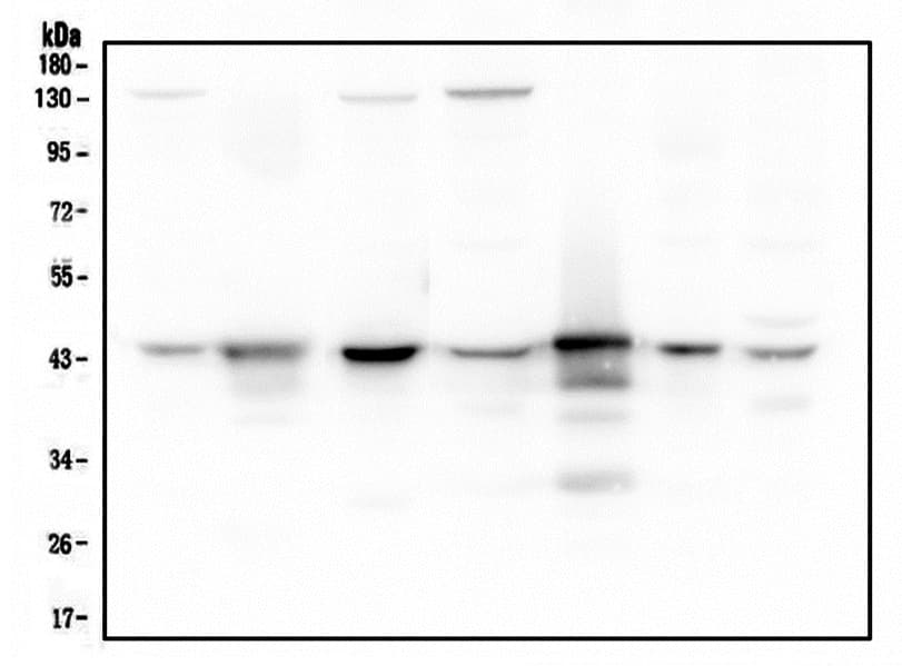 ADA / Adenosine Deaminase Antibody