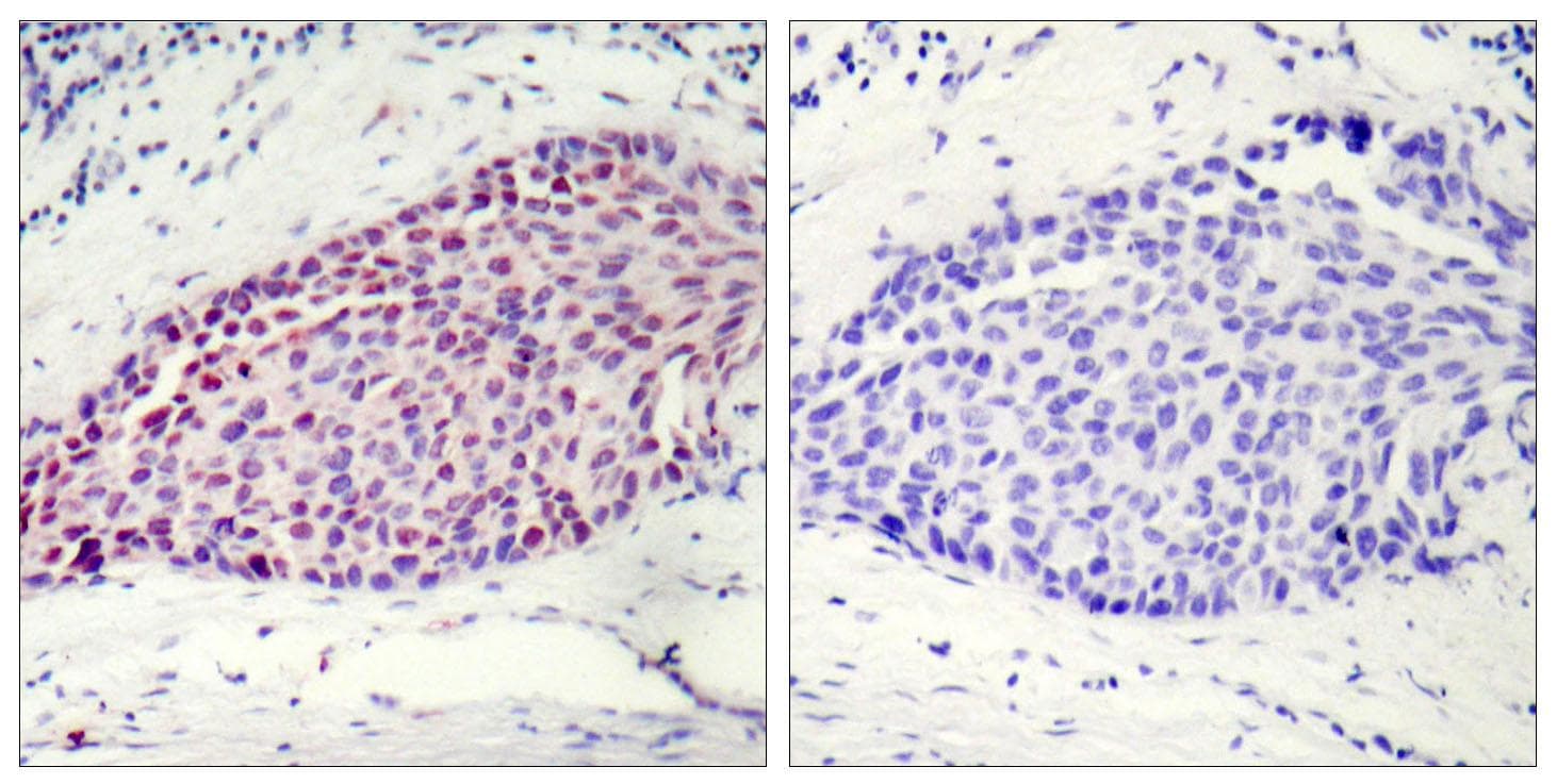 ATF2 Antibody (p112 or 94)