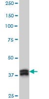 IHC-plus™ MBNL1 / MBNL Antibody (clone 3E7)