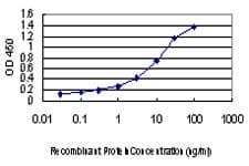 Monoclonal Mouse anti-Human PIH1D1 Antibody (clone 1E8, IHC, WB)