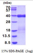 Human TRAIL-R3 / DCR1 Protein (Recombinant His)
