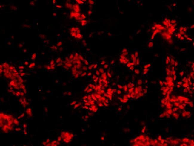 Goat Anti-Rabbit IgG Secondary Antibody (DY594)