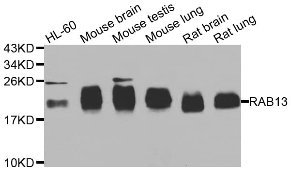 RAB31 Antibody