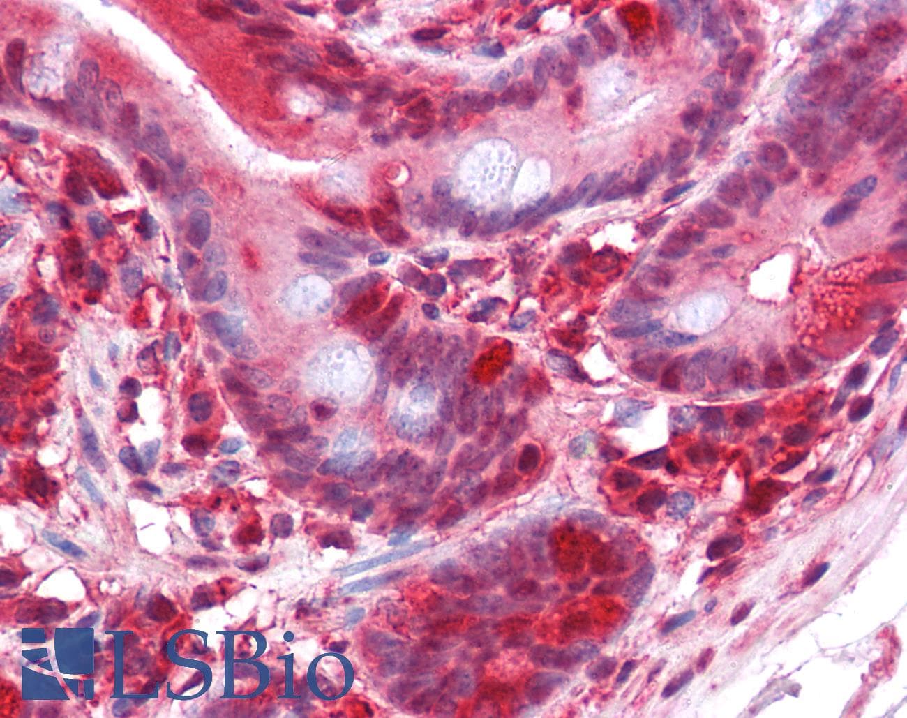 IHC-plus™ Monoclonal Mouse anti-Human PAWR / PAR4 Antibody (clone 3G9H7, IHC, WB)