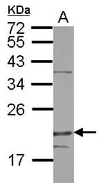 DENR / Density Regulated Antibody