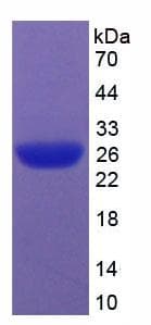 Rat CASP9 / Caspase 9 Protein (Recombinant His)