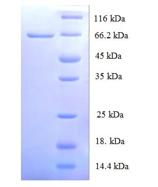 Human ORC4L / ORC4 Protein (Recombinant His-SUMO)
