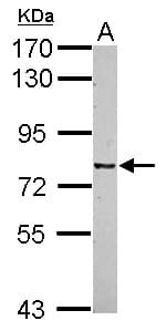 IHC-plus™ CSRP2BP Antibody