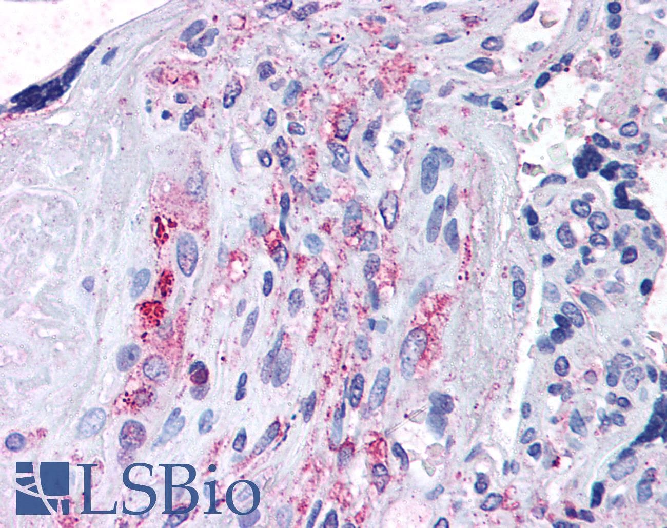 IHC-plus™ ADAMTS5 Antibody (N-Terminus)