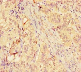 MMP12 Antibody
