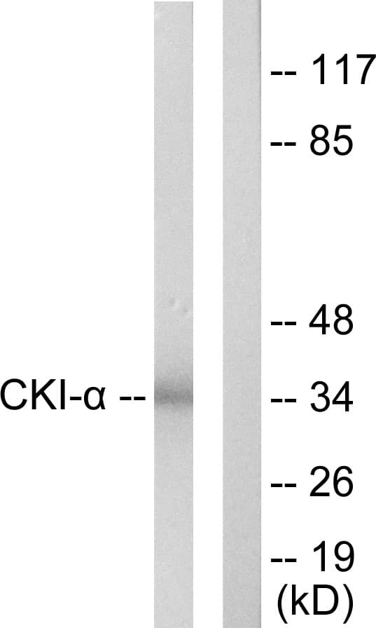 Polyclonal Rabbit anti-Human CSNK1A1 / CK1 Alpha Antibody (aa126-175, IHC, IF, WB)