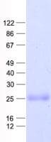 Human TMEM18 Protein (Recombinant His, N-Terminal)