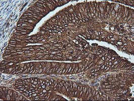 MAP2K1 / MKK1 / MEK1 Antibody (clone OTI2D4, Carrier-free)