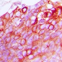 OXER1 Antibody (Internal)