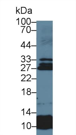USAG1 / SOSTDC1 Antibody (aa24-206)