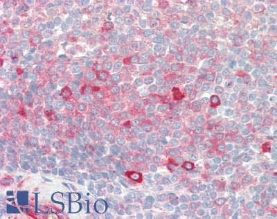 IHC-plus™ IFIT3 Antibody (aa1-490)
