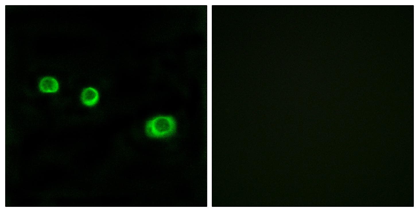 Polyclonal Rabbit anti-Human GBP1 Antibody (IF, WB)