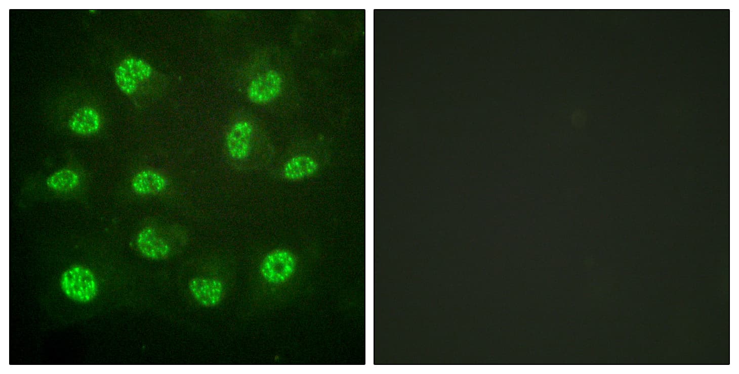 ESR2 / ER Beta Antibody (phospho-Ser105)