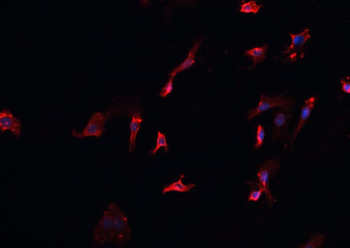 MID1 Antibody
