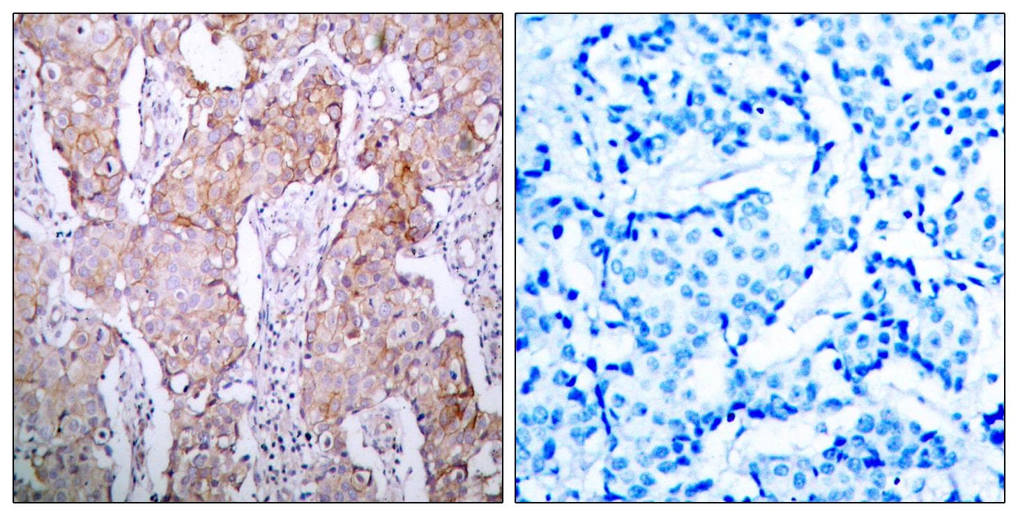 EGFR Antibody (phospho-Ser1070)