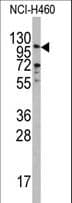 Polyclonal Rabbit anti-Human EXO1 Antibody (aa1-30, IF, WB)