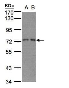Polyclonal Rabbit anti-Human RPA70 / RPA1 Antibody (aa369-616, IHC, WB)