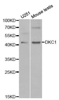Polyclonal Rabbit anti-Human DKC1 / Dyskerin Antibody (IHC, IF, WB)