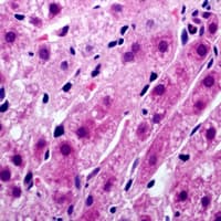 Tyrosinase Antibody (C-Terminus)