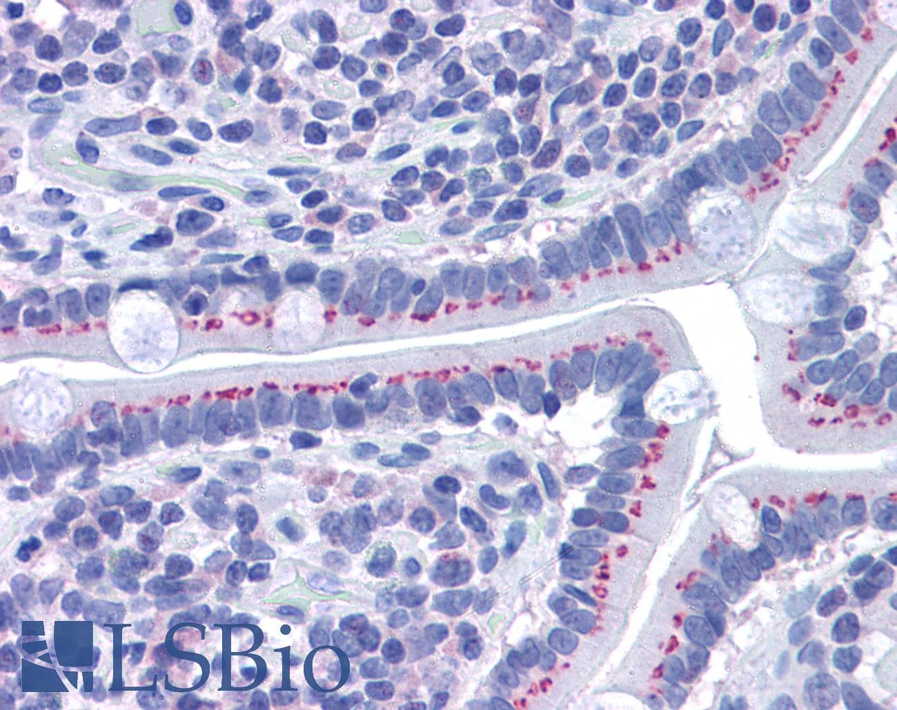 IHC-plus™ GOLM1 / GP73 / GOLPH2 Antibody (aa389-401)