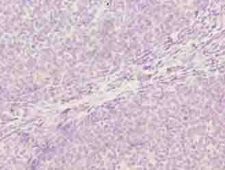 Polyclonal Rabbit anti-Human OXSM / KS Antibody (IHC)