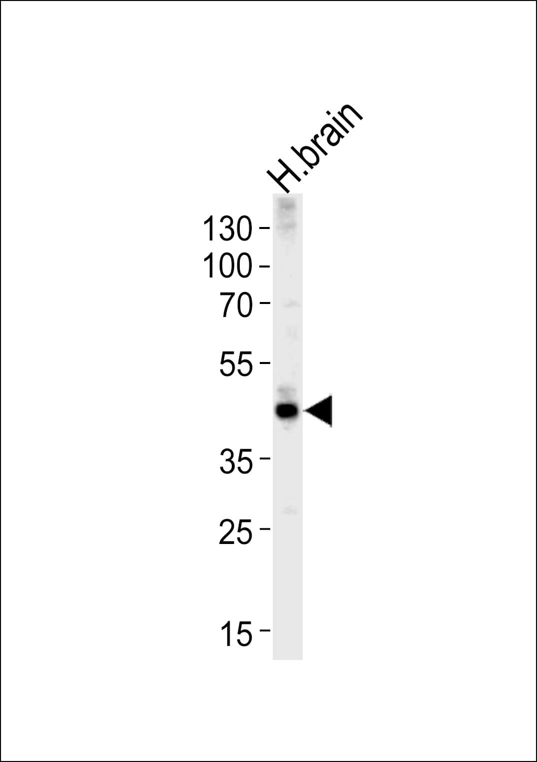 Polyclonal Rabbit anti-Human ALDOC / Aldolase C Antibody (aa72-101, WB)