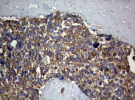 Monoclonal Mouse anti-Human PIK3C2A Antibody (clone OTI2D9, aa230-560, IHC, WB)