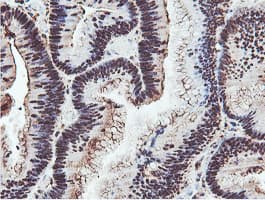 PSMB7 Antibody (clone OTI1E1)