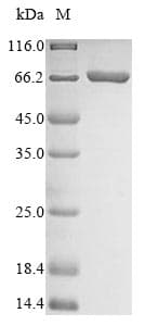 Candida albicans Acetyl-CoA Carboxylase / ACC Protein (Recombinant 10His, N-terminus)