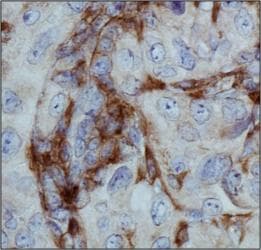 ITGAM / CD11b Antibody (Internal)