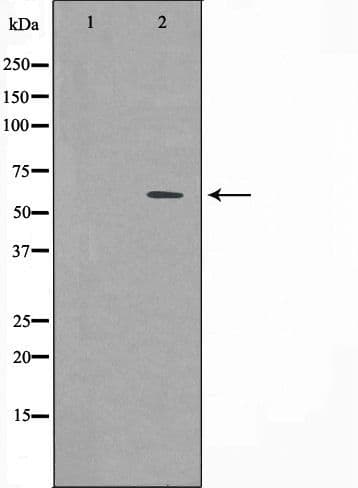 Polyclonal Rabbit anti-Human CSTF2 / CstF-64 Antibody (IF, WB)