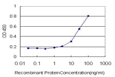 IHC-plus™ Monoclonal Mouse anti-Human ERBB3 / HER3 Antibody (clone 3F12, IHC)