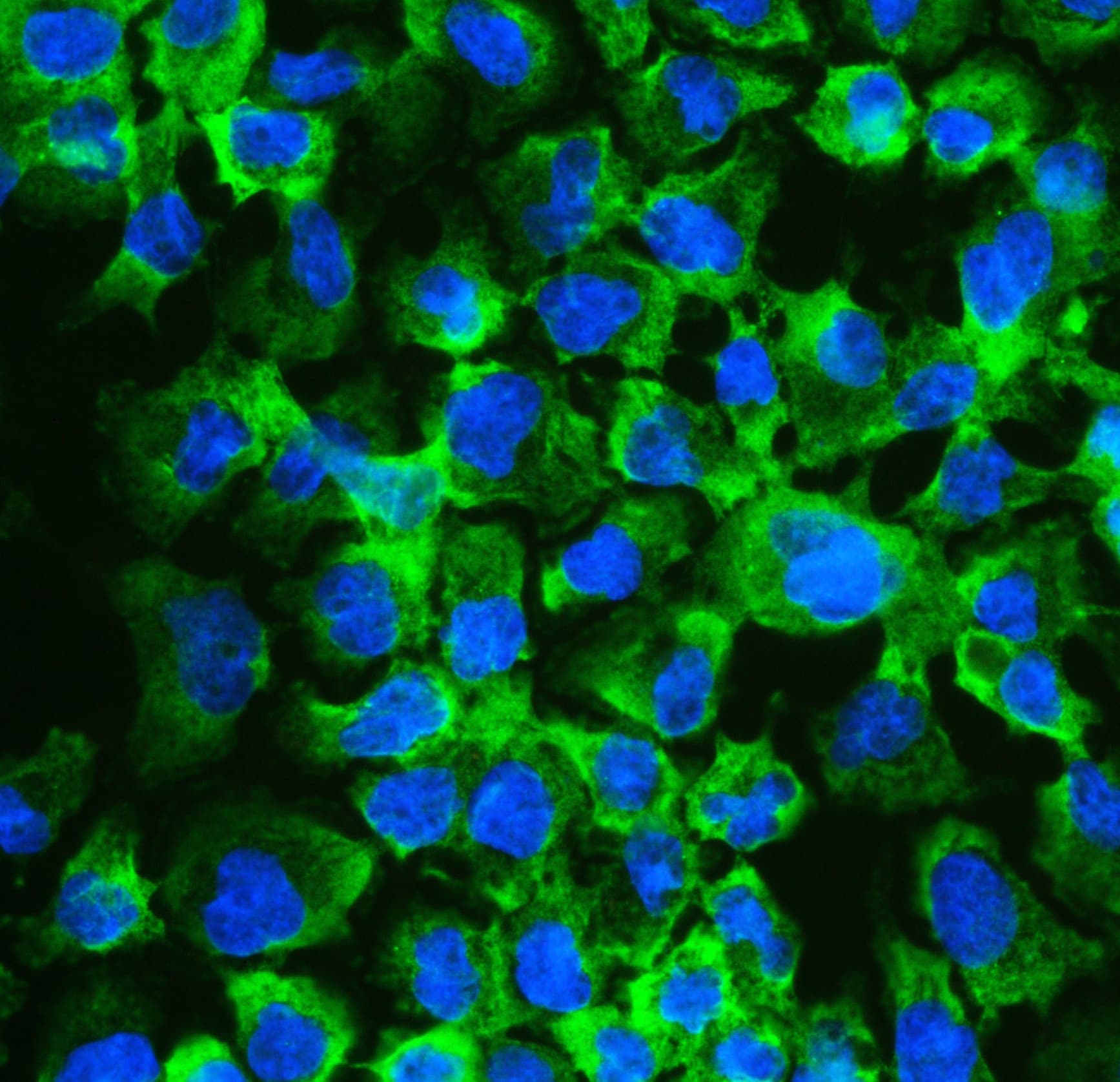 EIF4A2 Antibody (aa5-31)