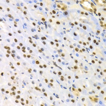 SFN / Stratifin / 14-3-3 Sigma Antibody