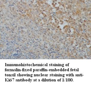 Polyclonal Rabbit anti-Human MKI67 / Ki67 Antibody (IHC, WB)