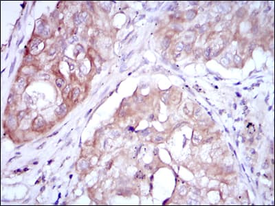 MTHFR Antibody (clone 5D3)